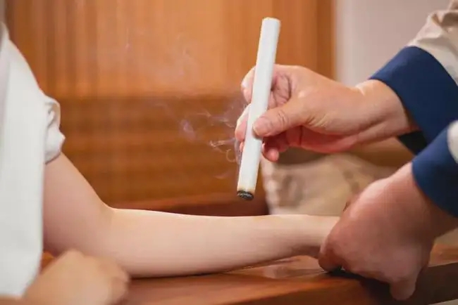 艾灸和拔罐的注意事項！